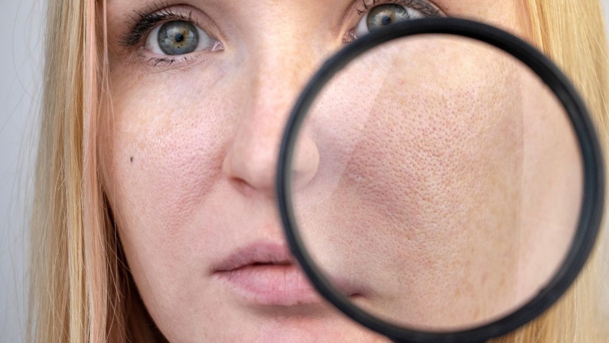 Imperfection de le peau et prise de complément zinc bisglycinate