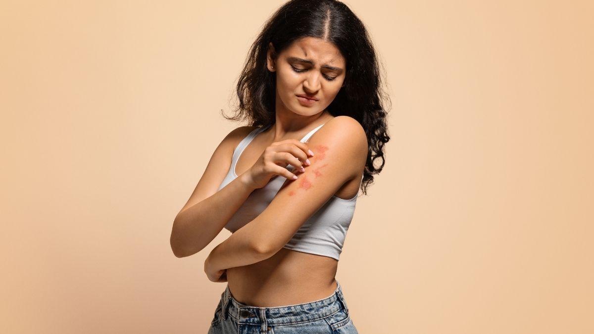 eczéma atopique et probiotiques